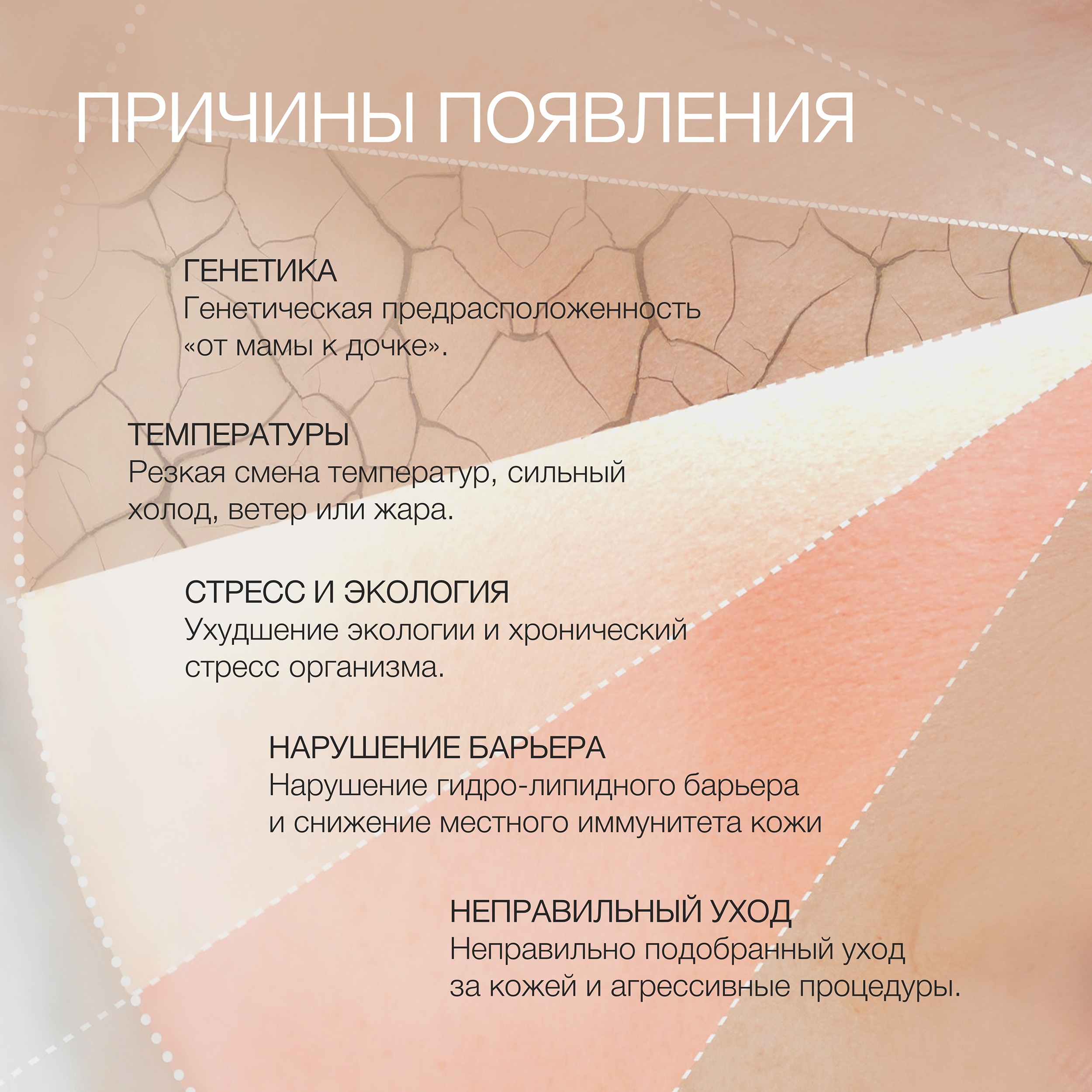 Пост чувствит кожа причины 3.jpg Пост чувствит кожа причины 3.jpg